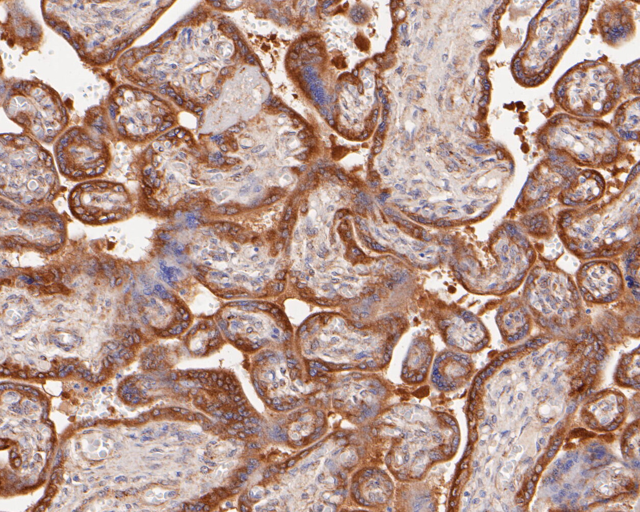 Bad Rabbit Monoclonal Antibody [SA3201] (ET16017) HUABIO