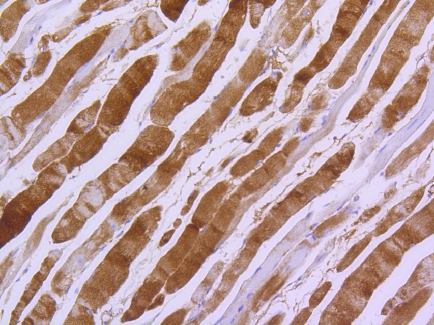 Myosin light chain kinase Rabbit Monoclonal Antibody [SU40