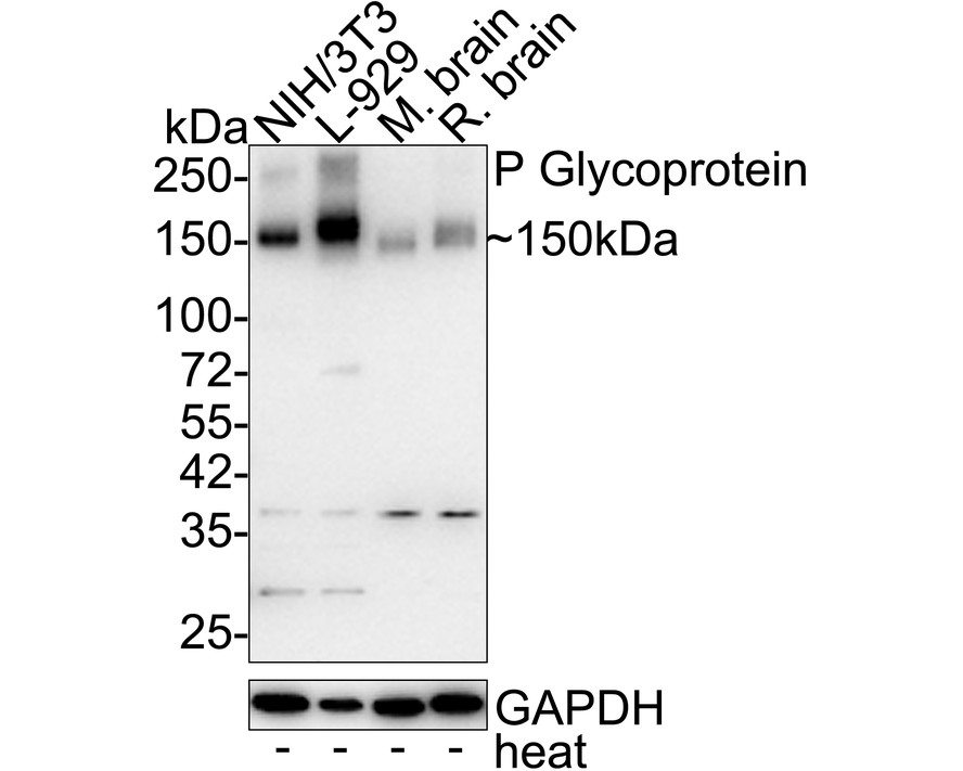 P Glycoprotein Rabbit Monoclonal Antibody [SN0642] (ET161 HUABIO
