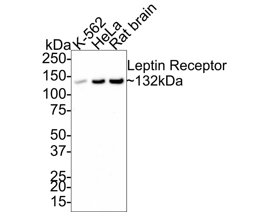 Leptin Receptor Rabbit Monoclonal Antibody [JA7301] (ET17