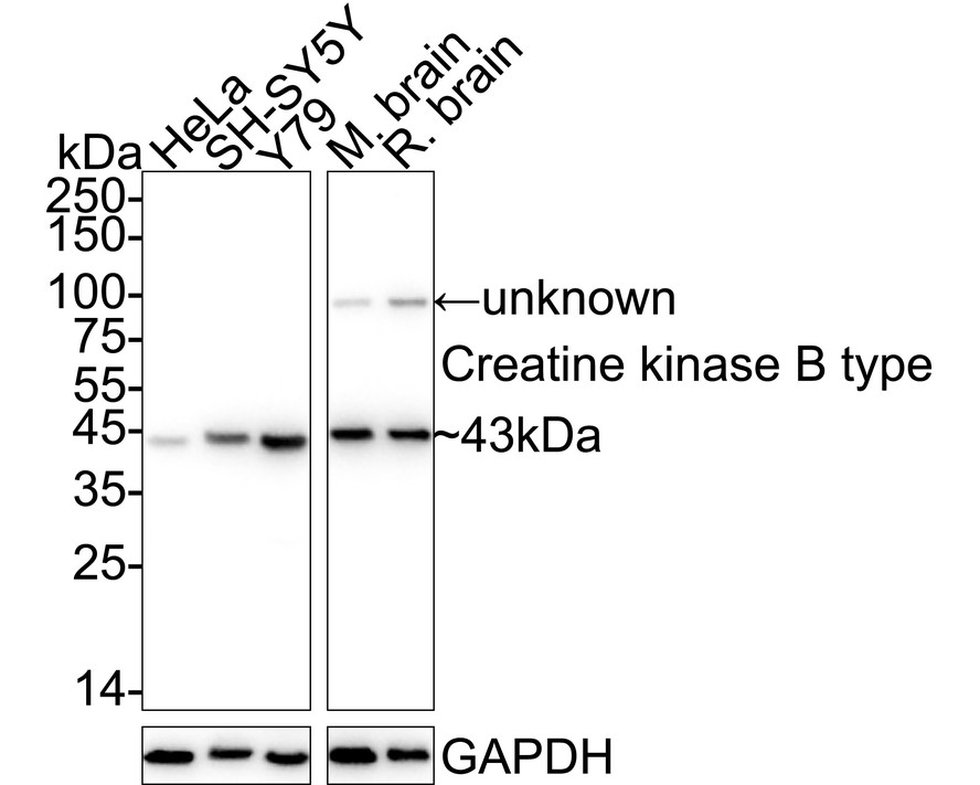 Creatine kinase B type Rabbit Monoclonal Antibody [JB7834