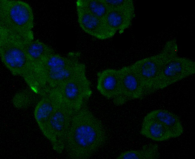 Alpha2macroglobulin Monoclonal Antibody (M151023) HUABIO