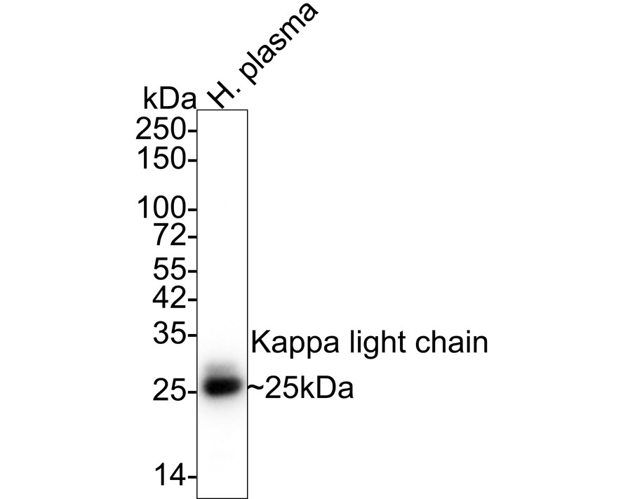 Human Kappa lightchain monoclonal Antibody (HA720014) HUABIO