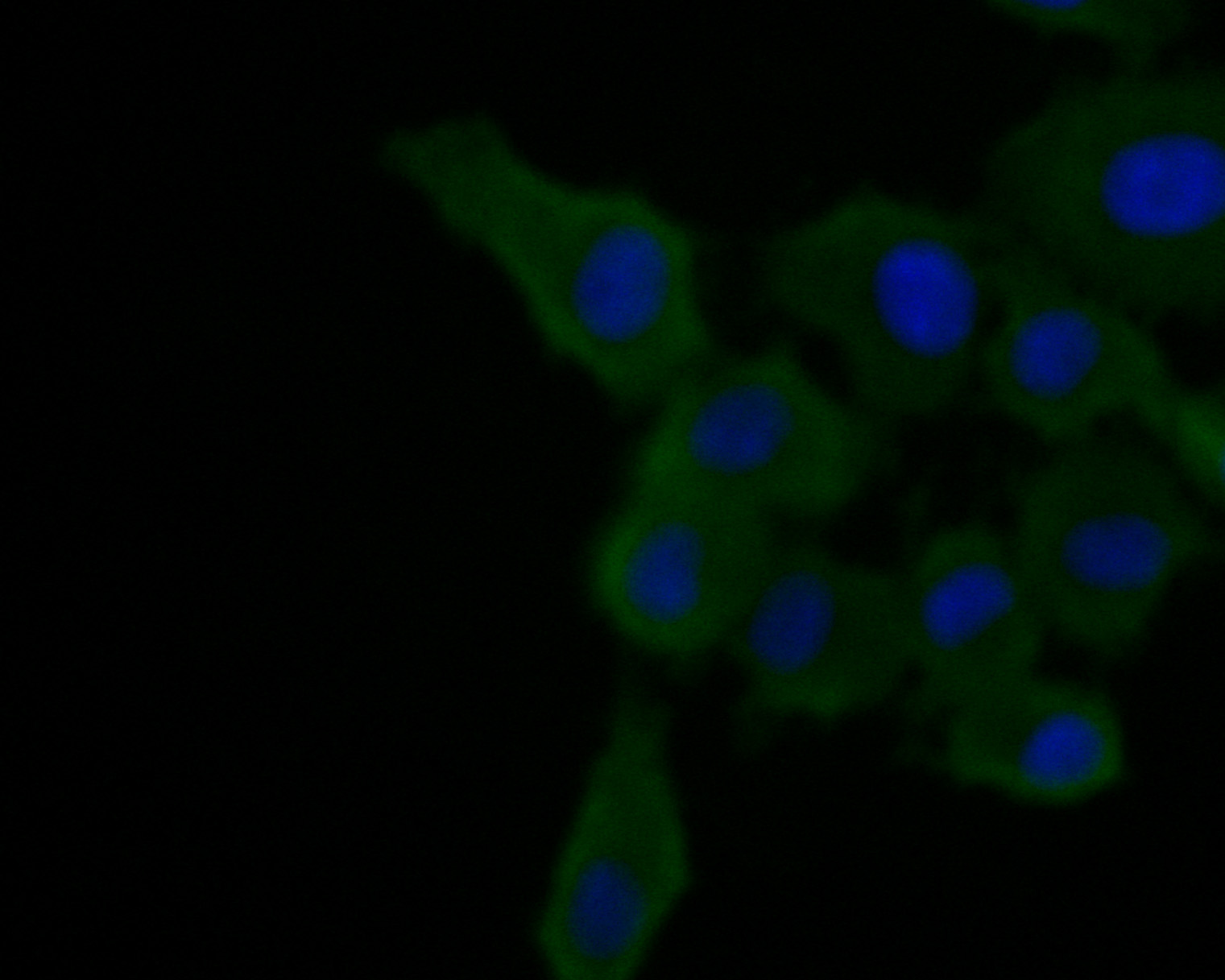 Alpha2macroglobulin Mouse Monoclonal Antibody [A5A9] (M151022) HUABIO