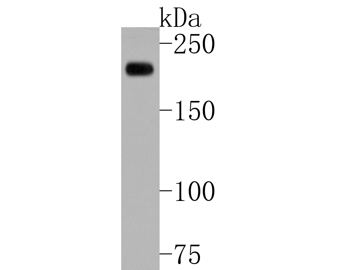 Alpha2macroglobulin Mouse Monoclonal Antibody [B1D7] (M151024) HUABIO
