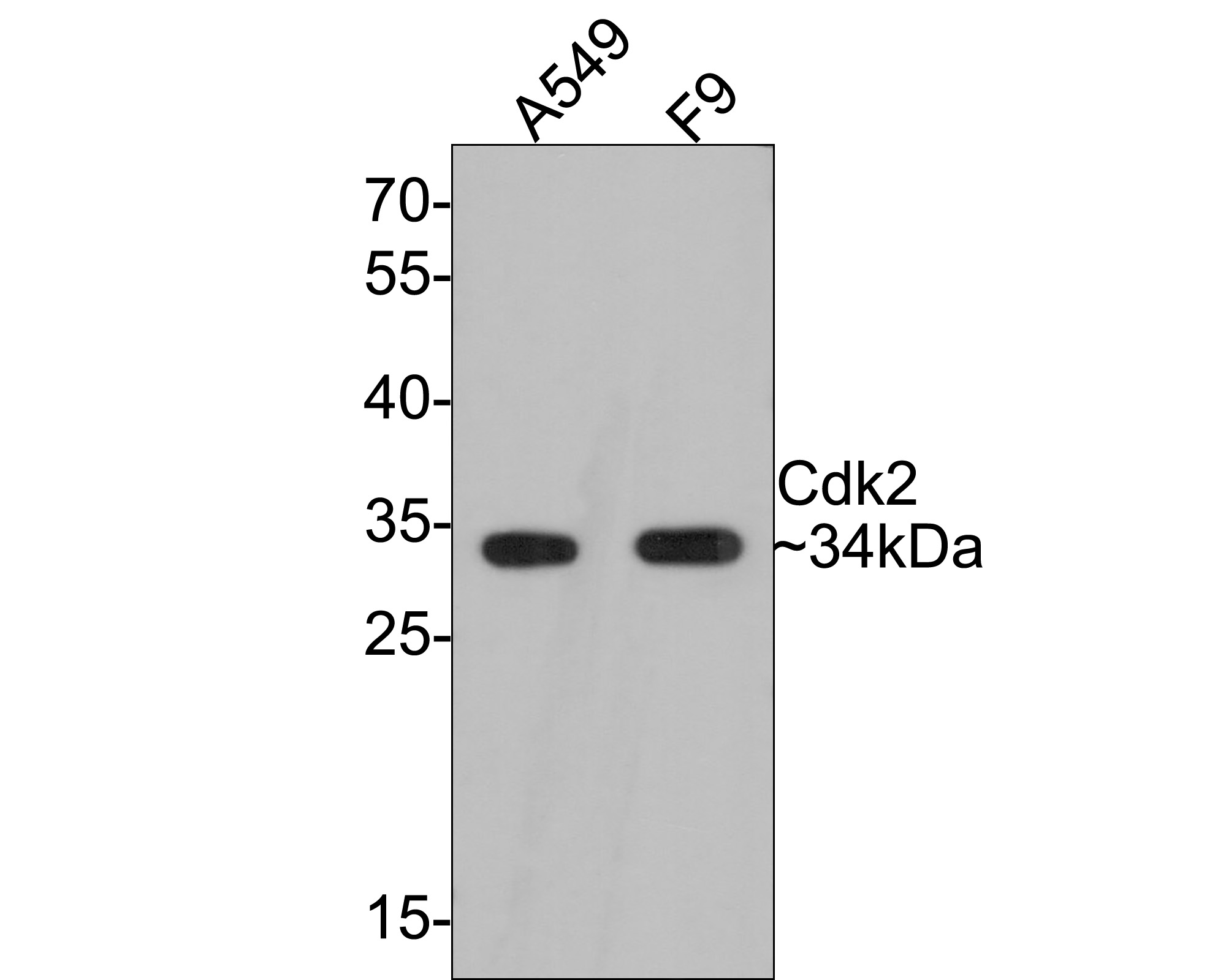 Cell Cycle Regulation Antibody Sampler Kit (HAK21039) HUABIO
