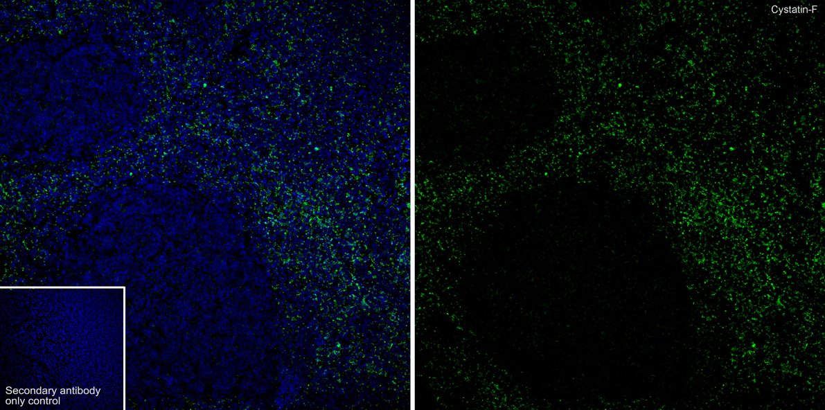 Cystatin F Rabbit Monoclonal Antibody [PSH0900] (HA723053