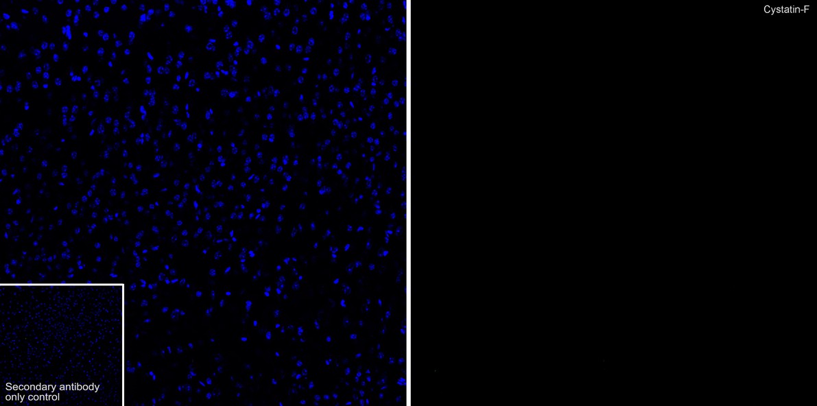 Cystatin F Rabbit Monoclonal Antibody [PSH0900] (HA723053
