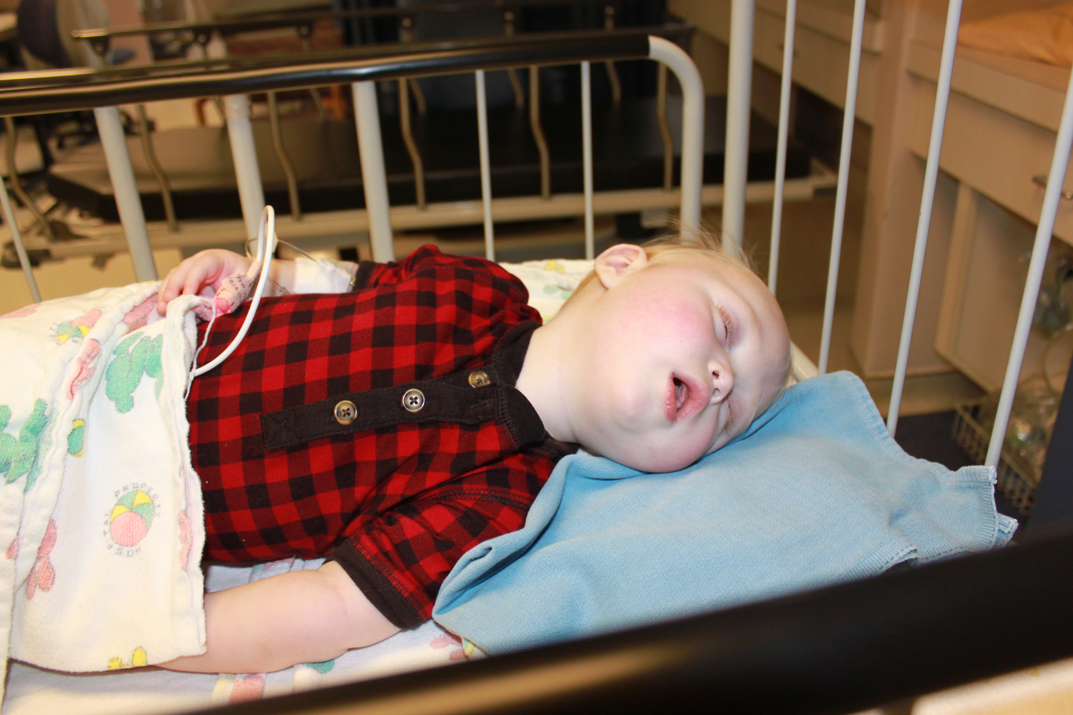 Sandifer Syndrome hudsonschallenge