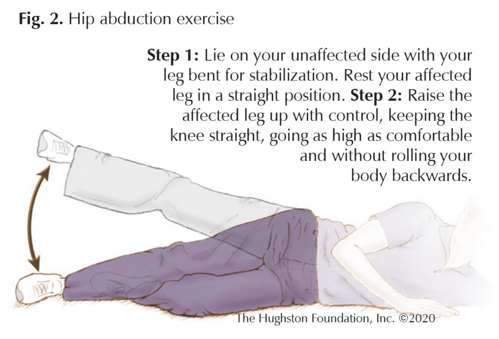 Greater Trochanteric Bursitis A Common Cause of Hip Pain Hughston