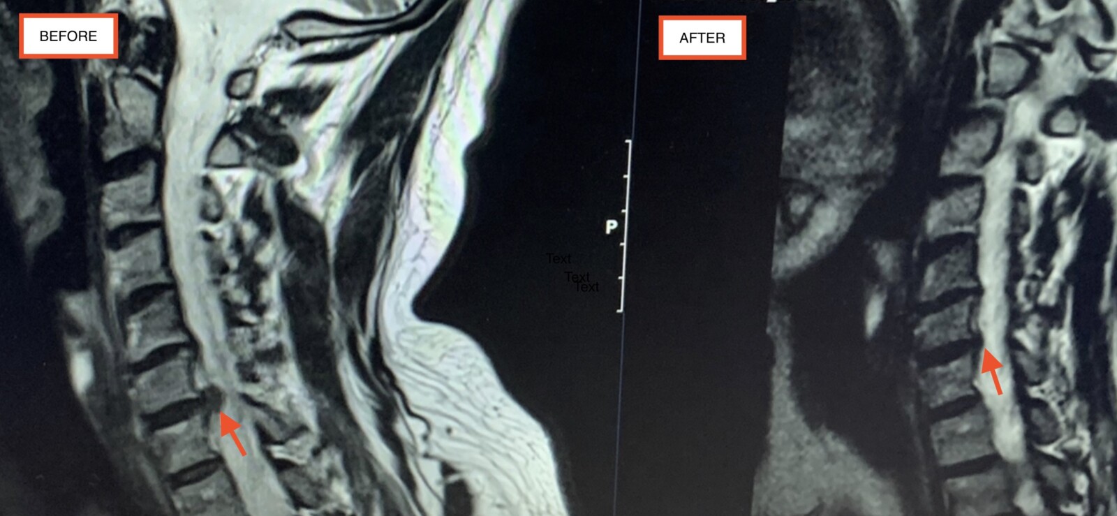 Golf, herniated discs and resistance training to help recovery Human Movement