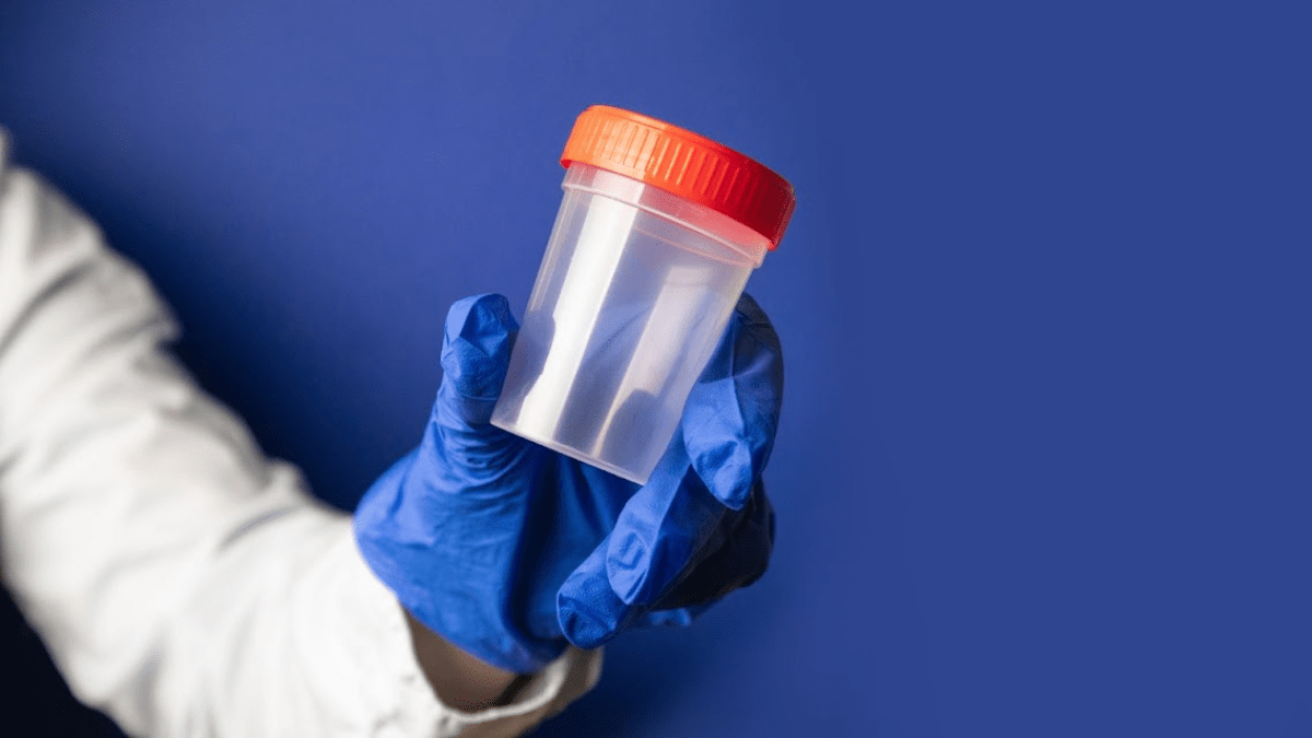 Exploring Most Common Drug Test For Employment The Hustler's Digest