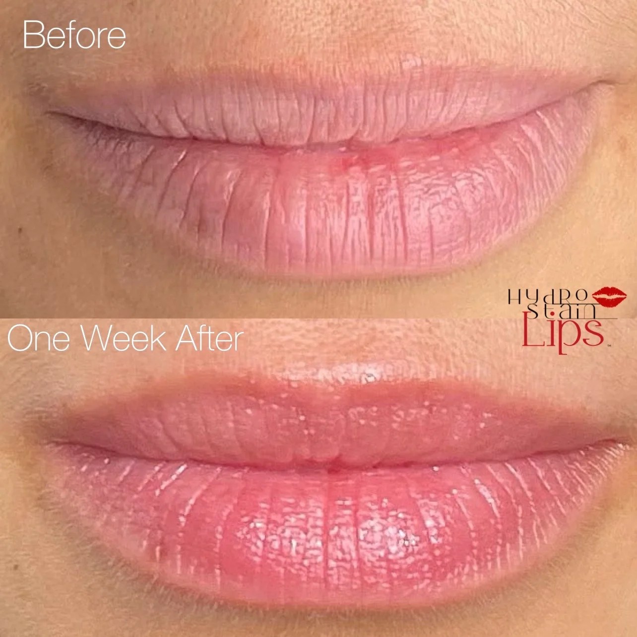 NanoPlump™ Plumping Lip Balm with Hyaluronic Acid and Peptides Sweet