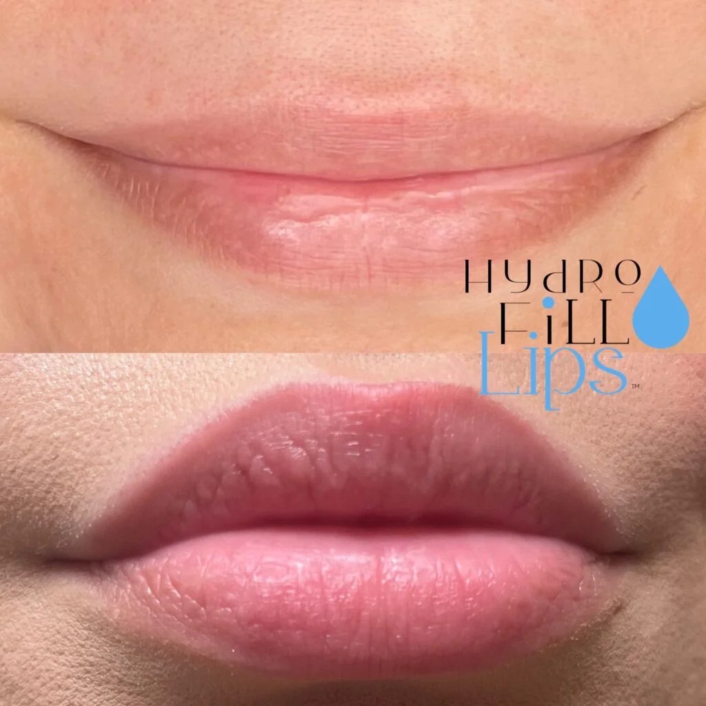 HydroFill Lips HydroStain Lips™