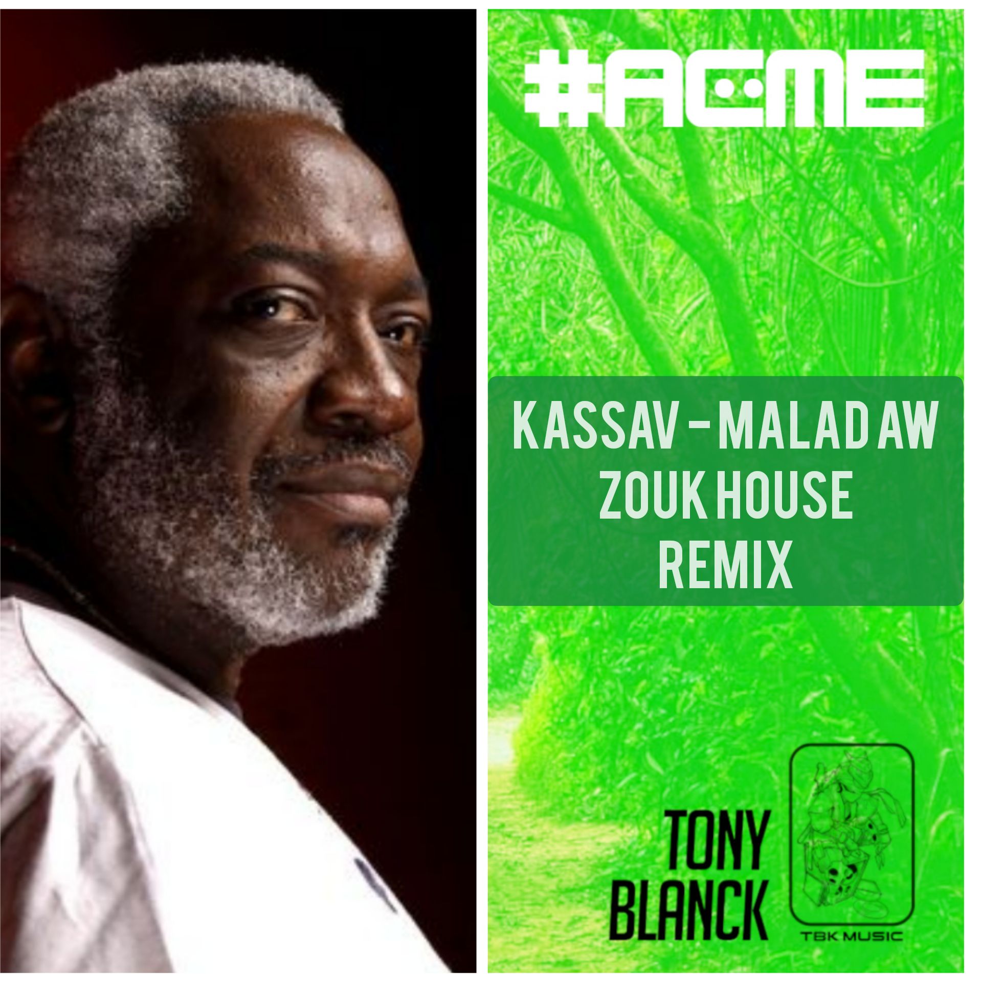 Kassav' Mwen Malad aw (DJ Tony Blanck Zouk House Remix) by DJ Tony