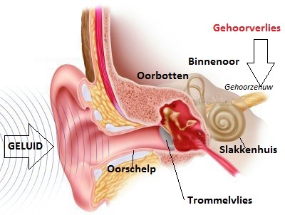 Knaltrauma - Antonius Hypercare