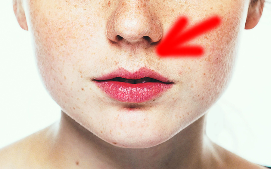 Filtro labial por que temos este buraquinho entre o nariz