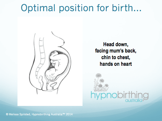 Do you have a baby in the breech or posterior position? Hypnobirthing
