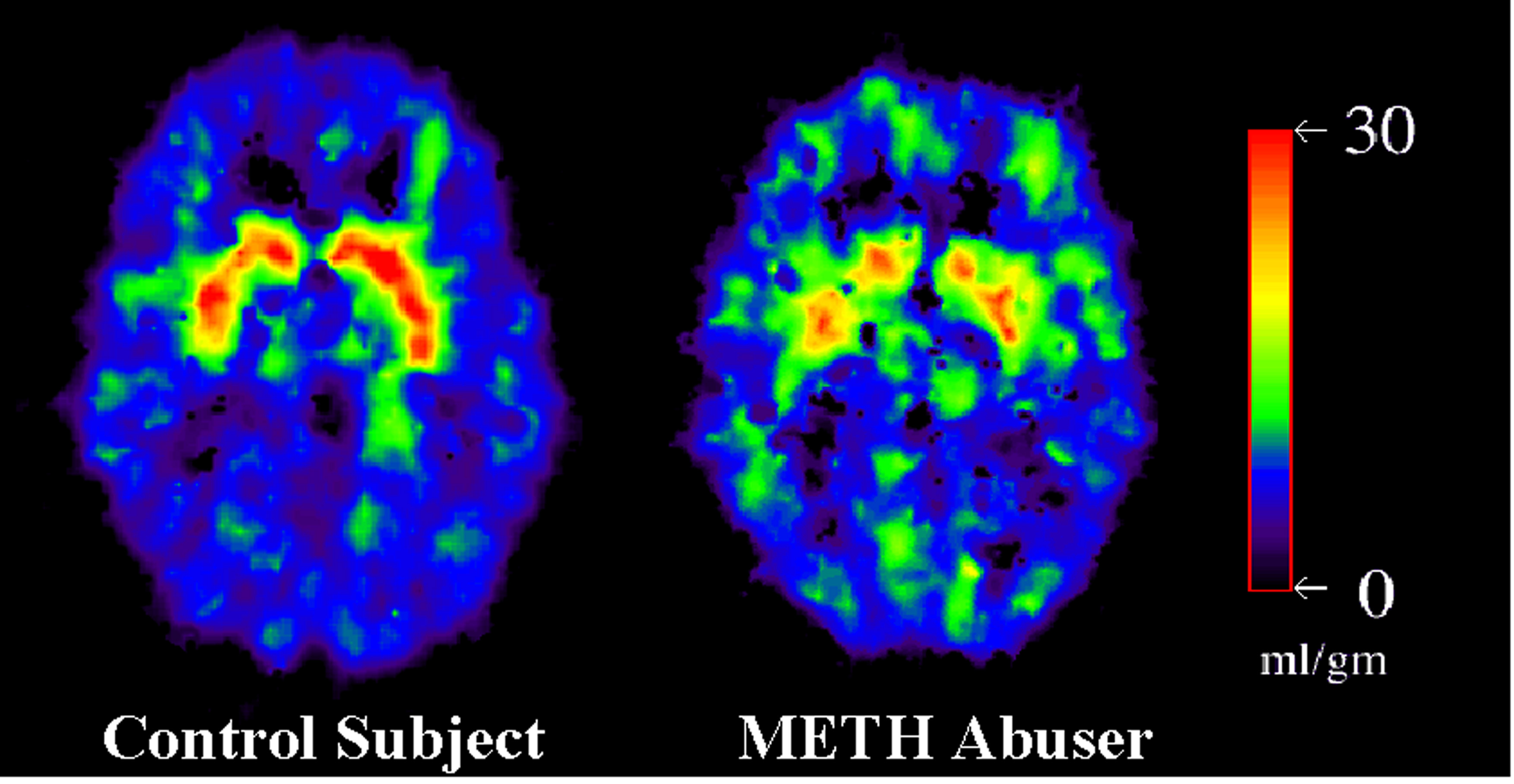 Sex and Methamphetamine SexInfo Online
