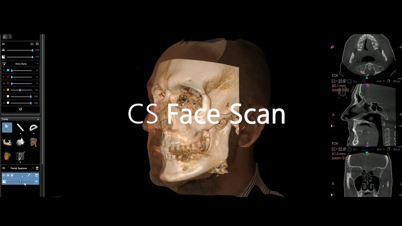 3D Dental Imaging Schedule a CBCT Scan Integrative Endodontics