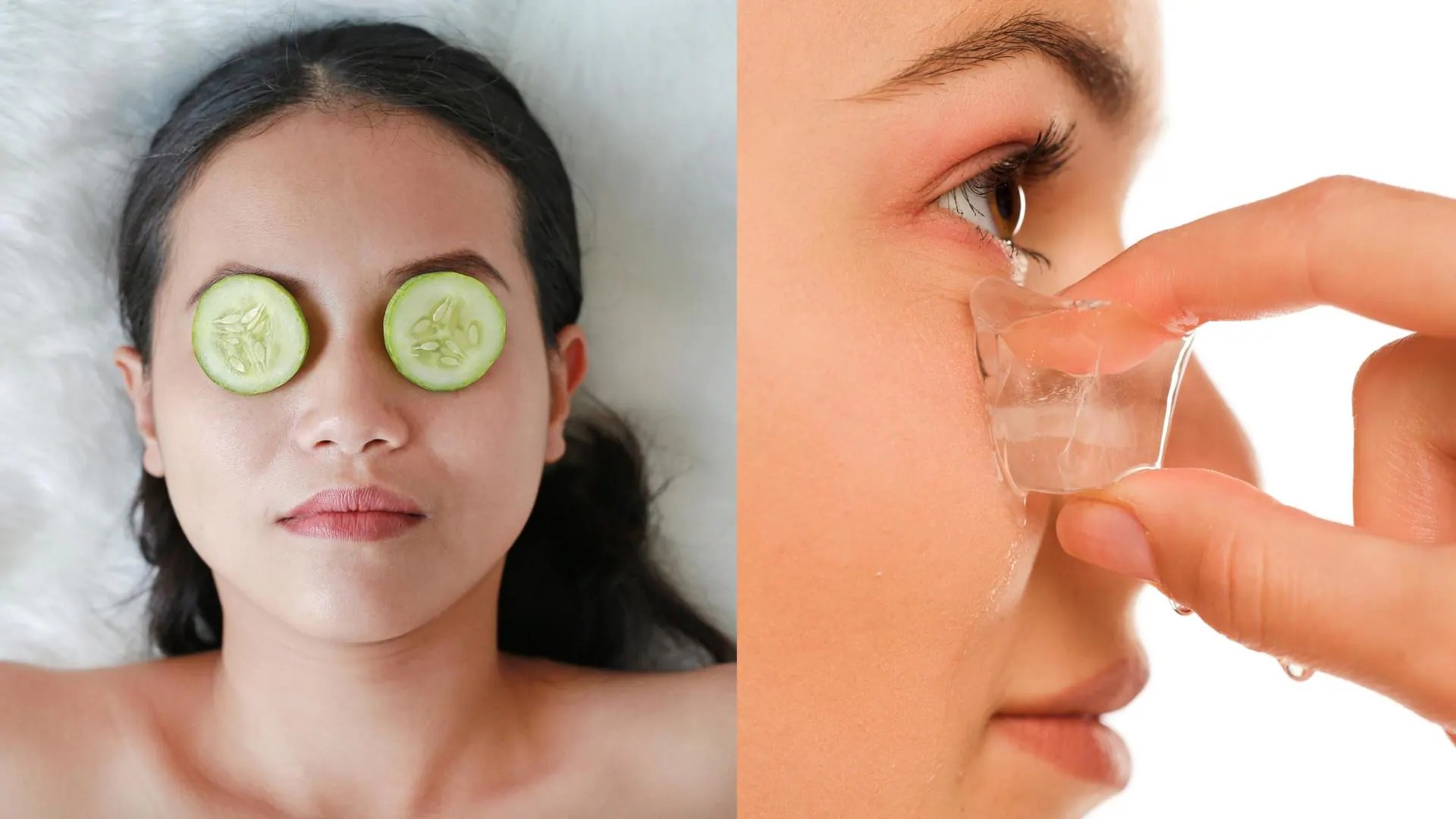 Undereye bags Home remedies to get rid of them