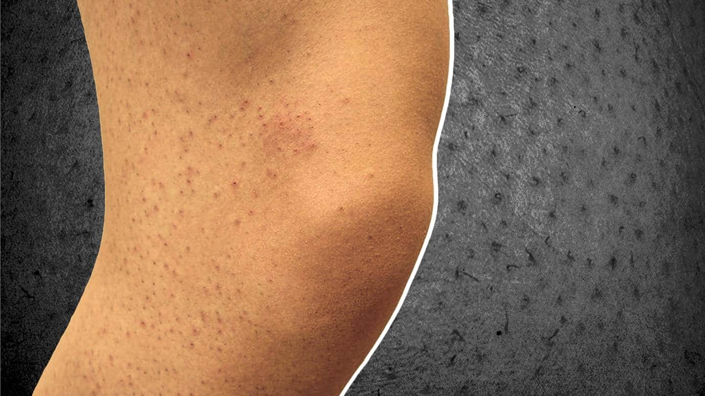 Everything you need to know about strawberry skin