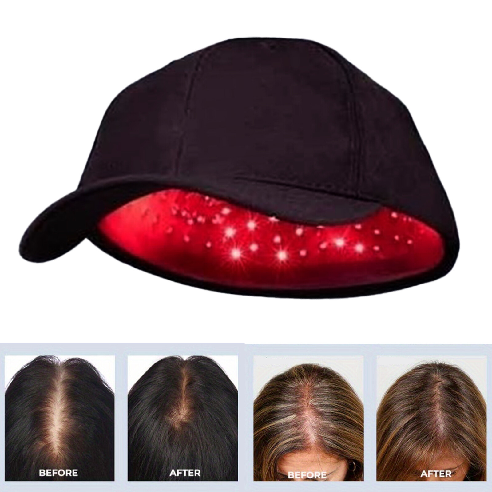 650nm Red Light Therapy Hair Loss Treatment Cap Growth Regrowth Helmet.tT eBay