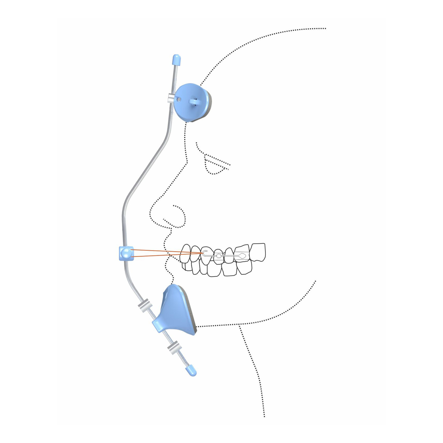 Dental Orthodontic Facemask Multi adjustable Middle Facial mask for