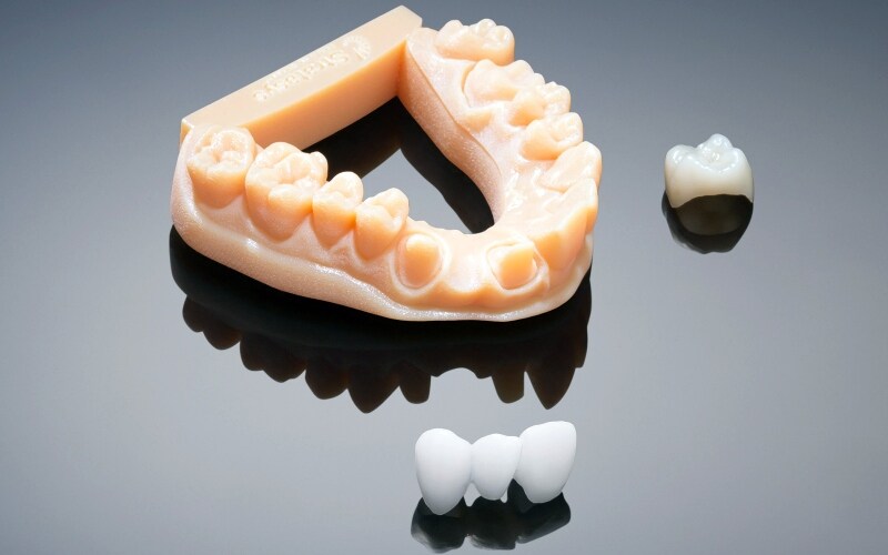 How 3D Printers Are Revolutionising Dentistry in India NDTV Gadgets 360