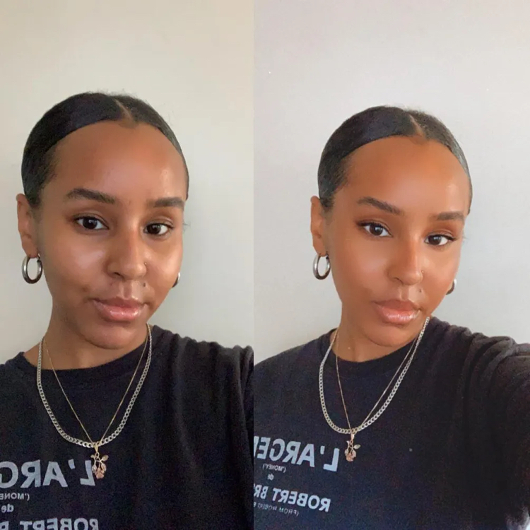 The Emergence of Face Dysmorphia Face Filters and Gua Shas VALLEY