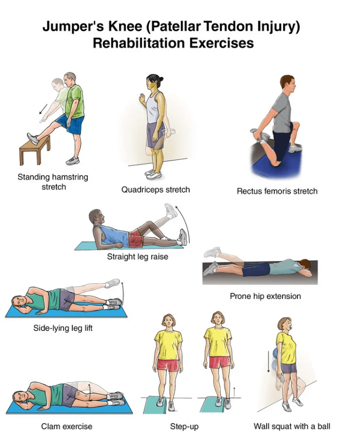 Patellar Tendinopati Jumper's Knee ve Fizyoterapi