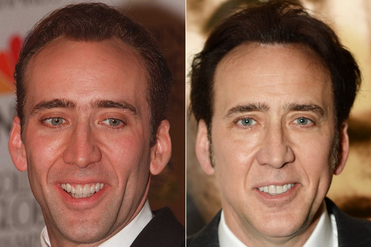 Celebrities Gone Dental Before And After Photos Of Toothy