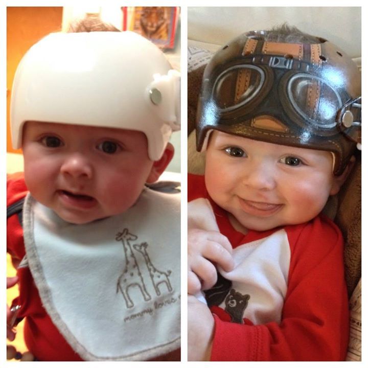 Attn Babies (Plagiocephaly/FlatHead Syndrome) BELLA BARGAINS BLOG