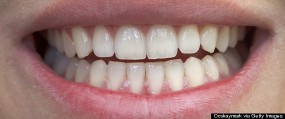 The 5 Biggest Dental Problems For People Over 50 HuffPost