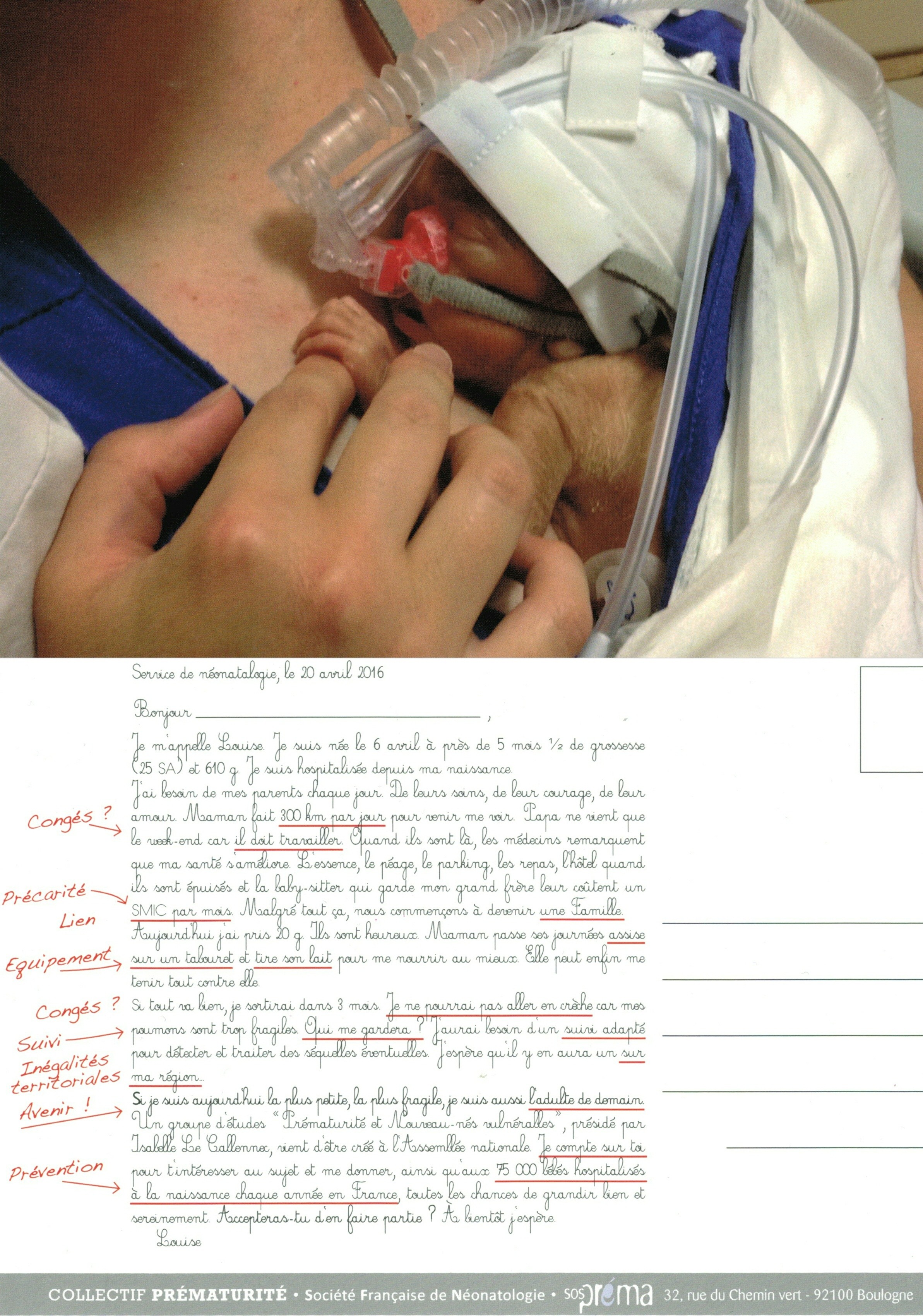 Cette photo de bébé prématuré a été envoyée à tous les
