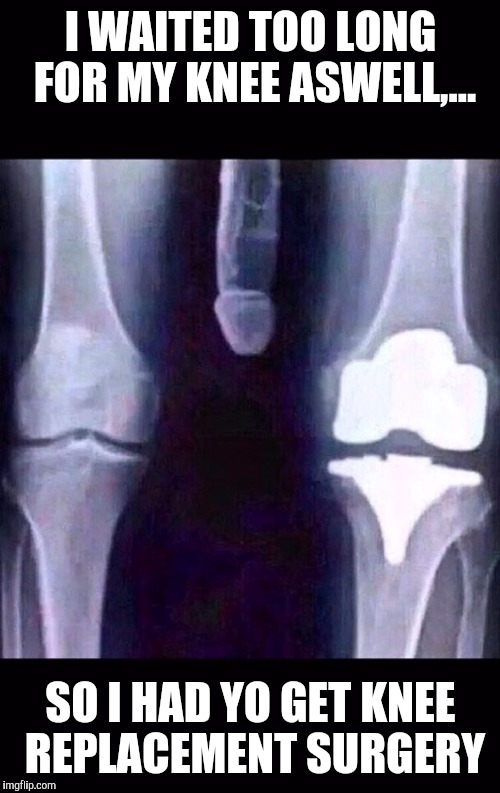 Accidentally kicked a wall about 2 weeks ago and my foot still hurts