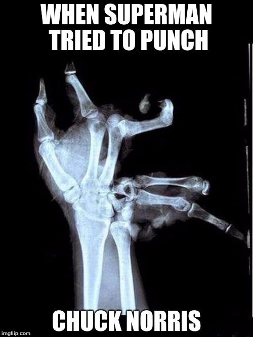 Chuck Norris can't be harmed, not even by Superman! A Sir_Unknown