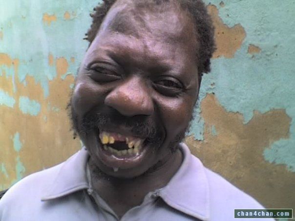 Funny Black Man With No Teeth TeethWalls