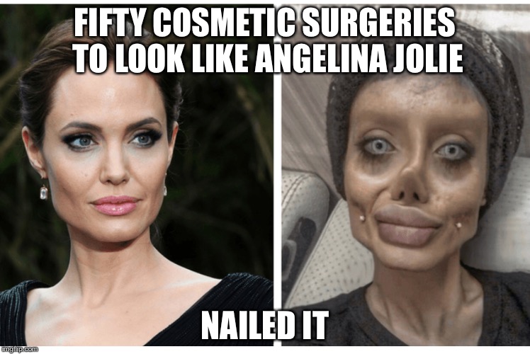 Plastic surgeons gone bad Imgflip