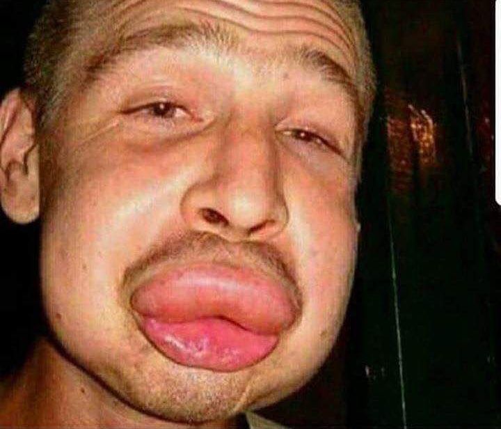 Big Lips Blank Template Imgflip