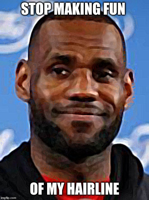 bad hairline Imgflip