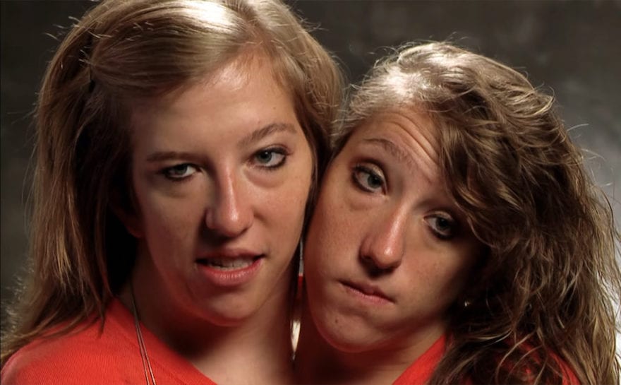 Siamese twins Memes Imgflip