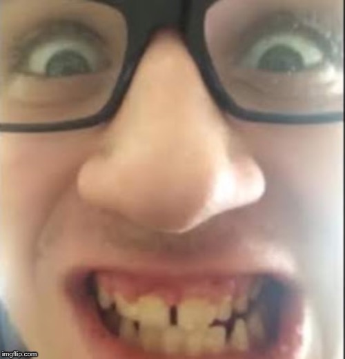 Braceless Andy Imgflip