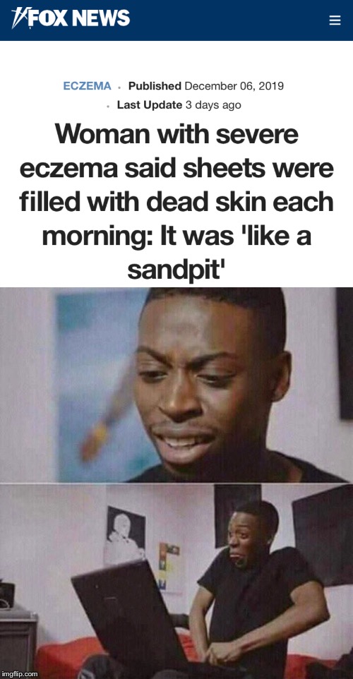 Image tagged in pants unzipped Imgflip