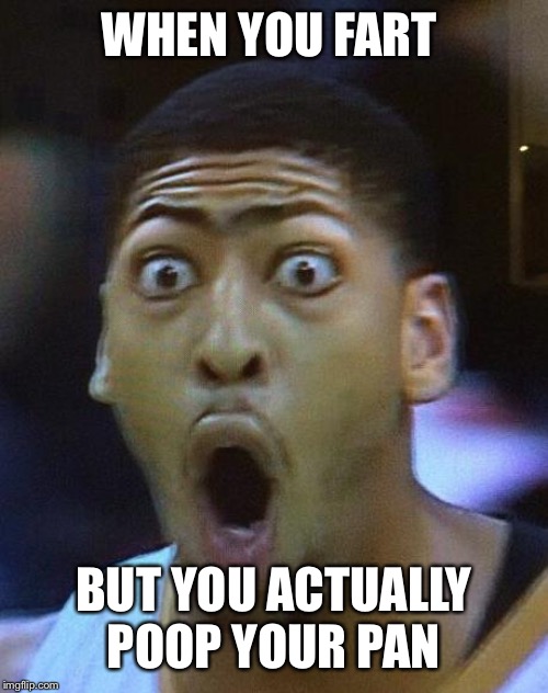 Shocked Face Imgflip
