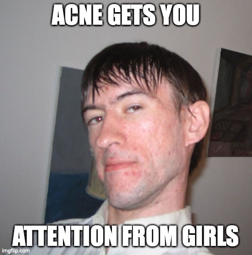 Acne Imgflip