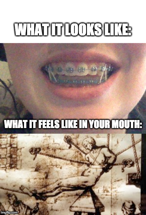 braces Memes & GIFs Imgflip