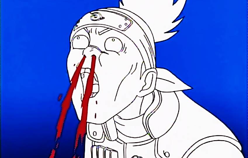 Surprised Nose bleed Blank Template Imgflip