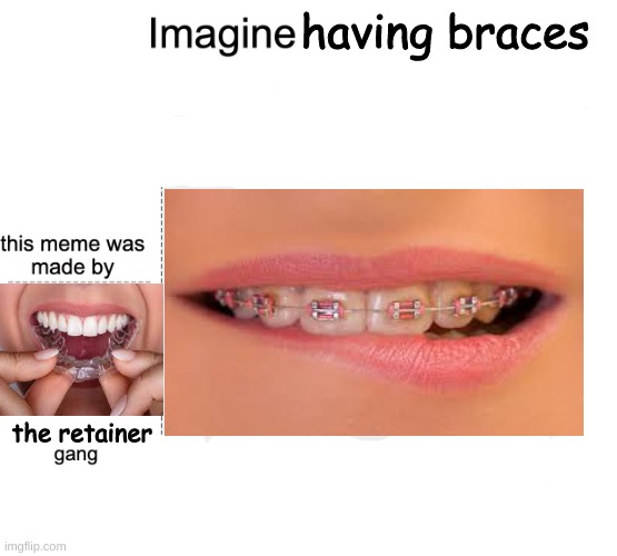 braces Imgflip