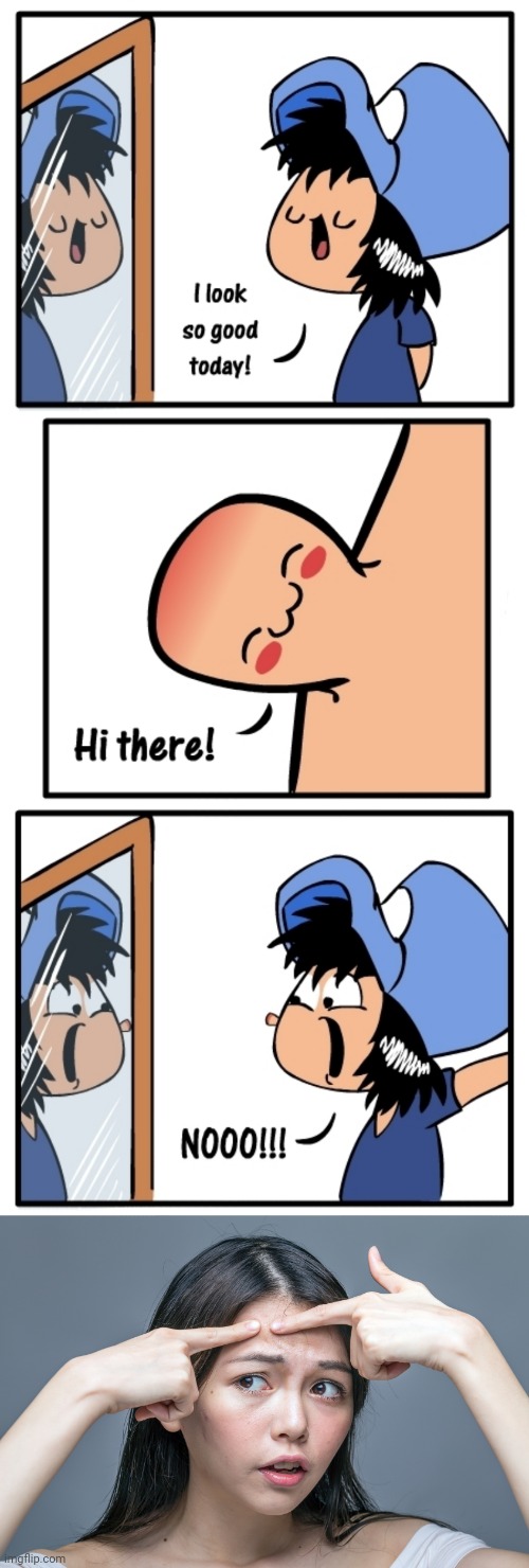Pimple on face Imgflip